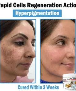 TODAHOF™ Bee Venom Multi-Symptom Skin Treatment Cream