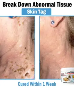 TODAHOF™ Bee Venom Multi-Symptom Skin Treatment Cream