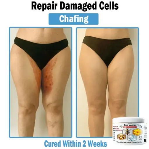 TODAHOF™ Bee Venom Multi-Symptom Skin Treatment Cream