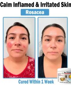 TODAHOF™ Bee Venom Multi-Symptom Skin Treatment Cream
