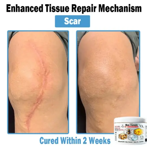 TODAHOF™ Bee Venom Multi-Symptom Skin Treatment Cream