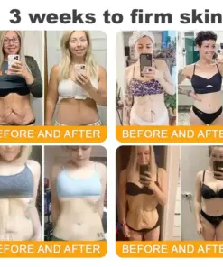 𝐓𝐎𝐃𝐀𝑯𝐎𝐅® 𝐁𝒆𝒆 𝐕𝒆𝐧𝐨𝐦 𝐂𝐨𝐦𝐩𝐫𝒆𝐡𝐞𝐧𝐬𝐢𝐯𝐞 𝐒𝐤𝐢𝐧 𝐑𝒆𝐬𝐭𝐨𝐫𝐚𝐭𝐢𝐨𝐧 𝐂𝐫𝒆𝐚𝐦