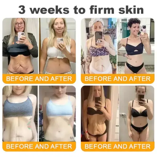 𝐓𝐎𝐃𝐀𝑯𝐎𝐅® 𝐁𝒆𝒆 𝐕𝒆𝐧𝐨𝐦 𝐂𝐨𝐦𝐩𝐫𝒆𝐡𝐞𝐧𝐬𝐢𝐯𝐞 𝐒𝐤𝐢𝐧 𝐑𝒆𝐬𝐭𝐨𝐫𝐚𝐭𝐢𝐨𝐧 𝐂𝐫𝒆𝐚𝐦