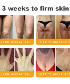 𝐓𝐎𝐃𝐀𝑯𝐎𝐅® 𝐁𝒆𝒆 𝐕𝒆𝐧𝐨𝐦 𝐂𝐨𝐦𝐩𝐫𝒆𝐡𝐞𝐧𝐬𝐢𝐯𝐞 𝐒𝐤𝐢𝐧 𝐑𝒆𝐬𝐭𝐨𝐫𝐚𝐭𝐢𝐨𝐧 𝐂𝐫𝒆𝐚𝐦