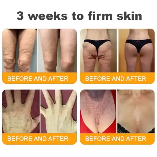 𝐓𝐎𝐃𝐀𝑯𝐎𝐅® 𝐁𝒆𝒆 𝐕𝒆𝐧𝐨𝐦 𝐂𝐨𝐦𝐩𝐫𝒆𝐡𝐞𝐧𝐬𝐢𝐯𝐞 𝐒𝐤𝐢𝐧 𝐑𝒆𝐬𝐭𝐨𝐫𝐚𝐭𝐢𝐨𝐧 𝐂𝐫𝒆𝐚𝐦