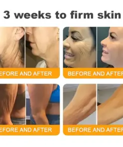 𝐓𝐎𝐃𝐀𝑯𝐎𝐅® 𝐁𝒆𝒆 𝐕𝒆𝐧𝐨𝐦 𝐂𝐨𝐦𝐩𝐫𝒆𝐡𝐞𝐧𝐬𝐢𝐯𝐞 𝐒𝐤𝐢𝐧 𝐑𝒆𝐬𝐭𝐨𝐫𝐚𝐭𝐢𝐨𝐧 𝐂𝐫𝒆𝐚𝐦