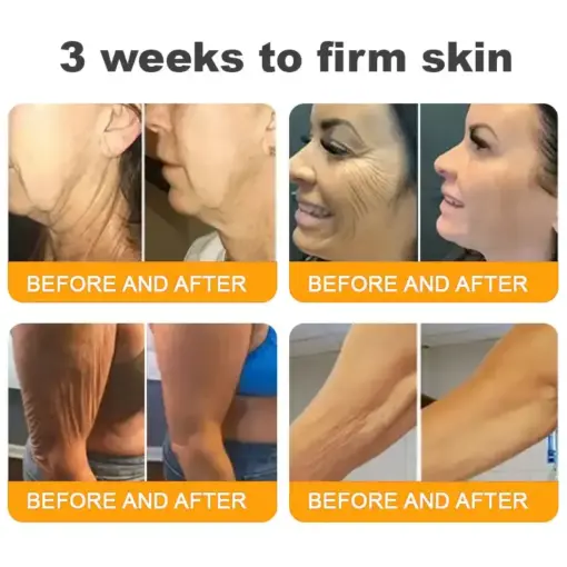 𝐓𝐎𝐃𝐀𝑯𝐎𝐅® 𝐁𝒆𝒆 𝐕𝒆𝐧𝐨𝐦 𝐂𝐨𝐦𝐩𝐫𝒆𝐡𝐞𝐧𝐬𝐢𝐯𝐞 𝐒𝐤𝐢𝐧 𝐑𝒆𝐬𝐭𝐨𝐫𝐚𝐭𝐢𝐨𝐧 𝐂𝐫𝒆𝐚𝐦